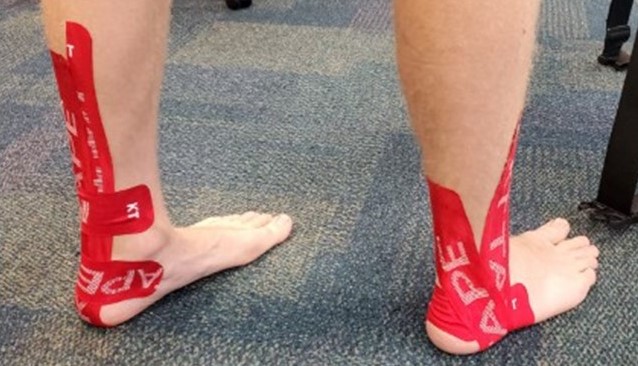 2 Ankle Taping