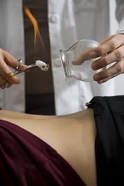 cupping demonstration