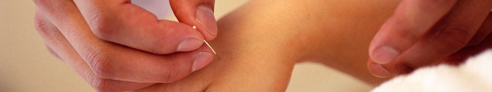 acupuncture on hand