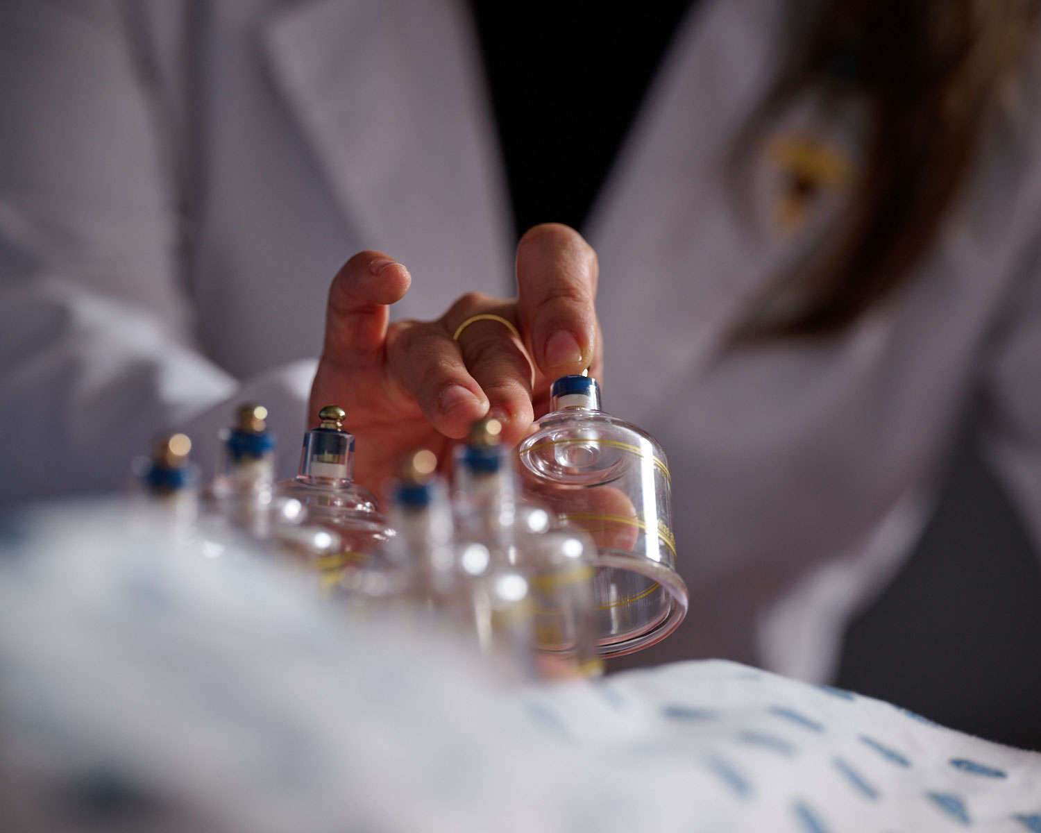 cupping demonstration