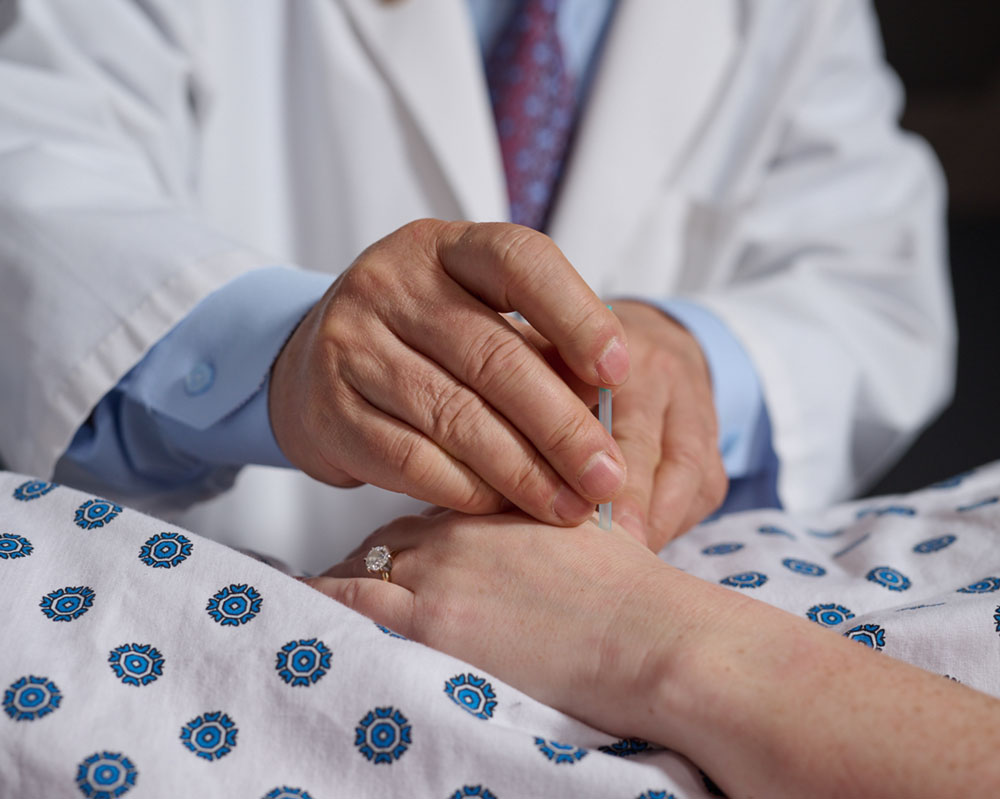 acupuncture therapist inserting needle on patient hand