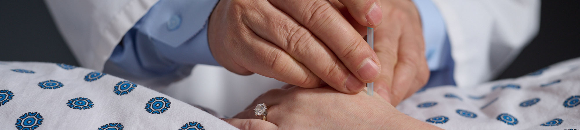 teacher demonstrating acupuncture dry needling